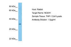 AADACL1 Antibody, Novus Biologicals 100 &mu;L | Buy Online | Novus Biologicals | Fisher Scientific
